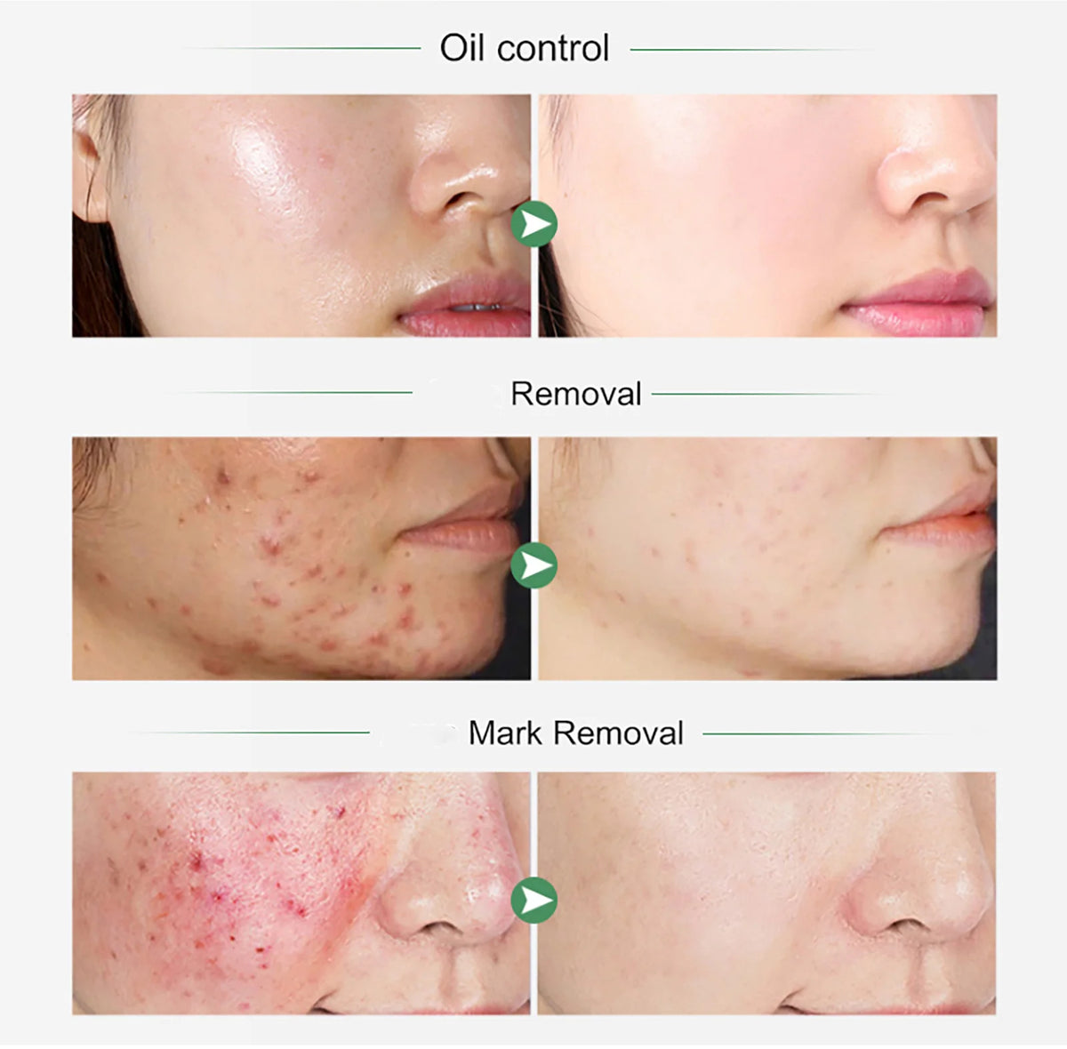 AILKE Tumeric & Vitamin C SkinCare Set,